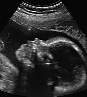 Genetikai vizsgálatok a terhesség alatt: mikor kötelező, mikor ajánlott?