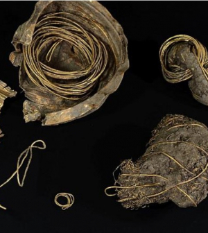 Háromezer éves aranykincset találtak Ausztriában