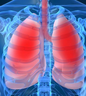 Betegségek, amik a tüdőt támadják