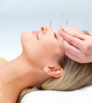 Az akupunktúra egyidőben szépít és gyógyít